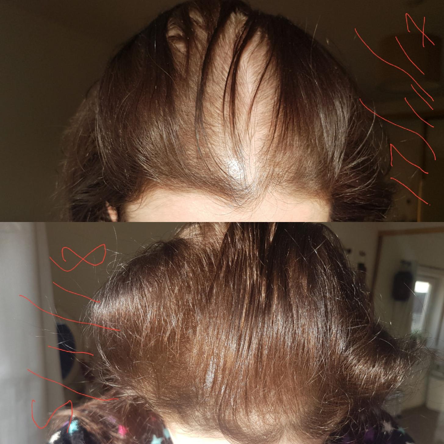 Product One Woman's Hair Back in Just a Month and a Half NewBeauty