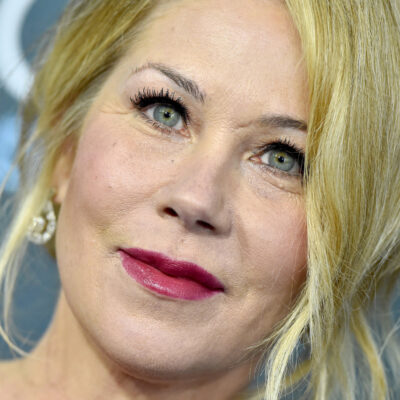 Christina Applegate's eye bag removal