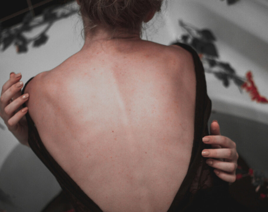 Girl holding herself with bare back exposed